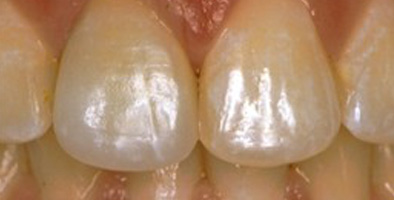 75077 Cosmetic Dental Office