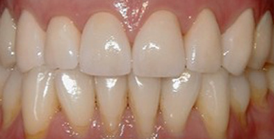 Lewisville Cosmetic Dentist