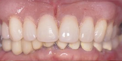 Emergency Dentist Lewisville