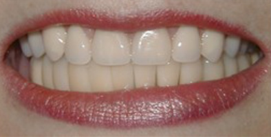 Family Dentist Lewisville