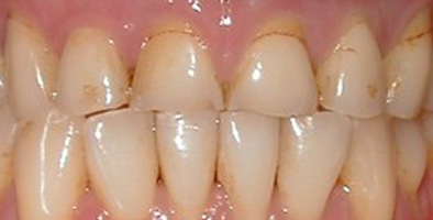 Dentist 75077