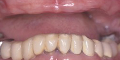 Lewisville Cosmetic Dentist