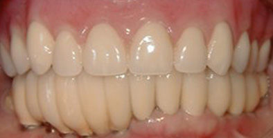 Dentist in Lewisville